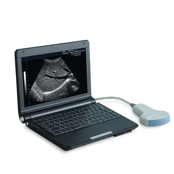 Uman, Veterinar La Animale Original De Diagnosticare Cu Ultrasunete Sistem De Imagistică Digitală Cu Ultrasunete Laptop Scanner Cu Ultrasunete